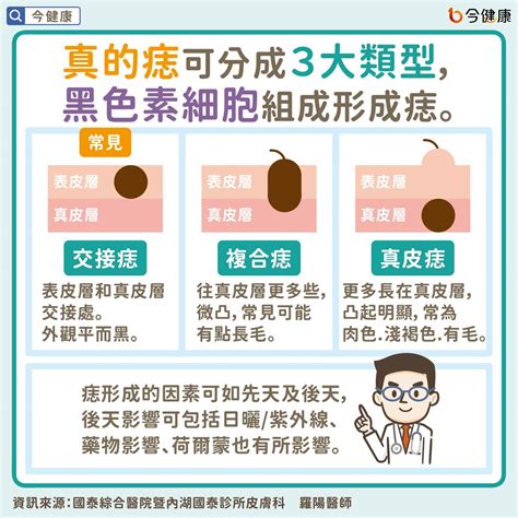 痣為什麼會長毛|是痣？皮膚癌？還是什麼？常見Q&A解惑！醫教揪出「。